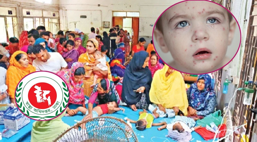 ২৪ ঘণ্টায় হামের উপসর্গে ১১ শিশুর মৃত্যু, বাড়ছে রোগী