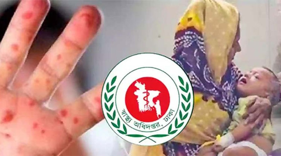সিলেটে হামের উপসর্গে ২৪ ঘণ্টায় আরও ৩ শিশুর মৃত্যু, মোট মৃত্যু ৭২