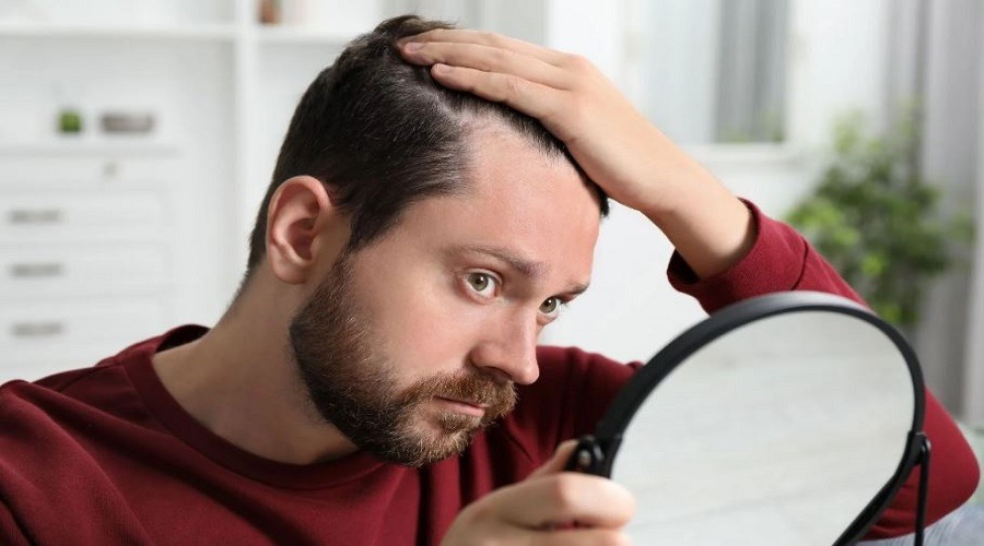 মানসিক চাপেও কি চুল পড়ে?