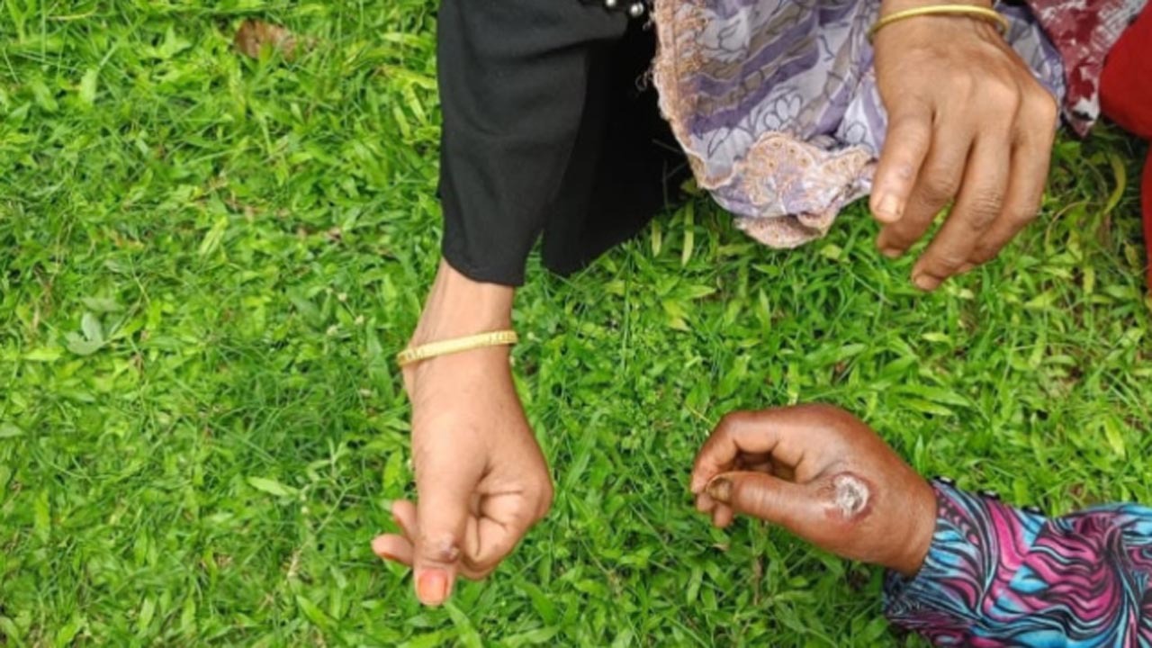 দেশে অ্যানথ্রাক্স ছড়িয়ে পড়ার আশঙ্কা, দেশজুড়ে স্বাস্থ্য ও প্রাণিসম্পদ বিভাগের সতর্কতা